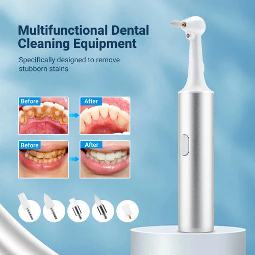 5-in-1 Electric Tooth Polisher & Tartar Remover – USB Rechargeable