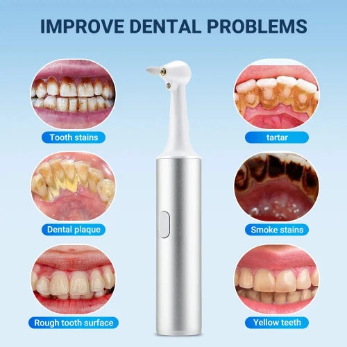 5-in-1 Electric Tooth Polisher & Tartar Remover – USB Rechargeable